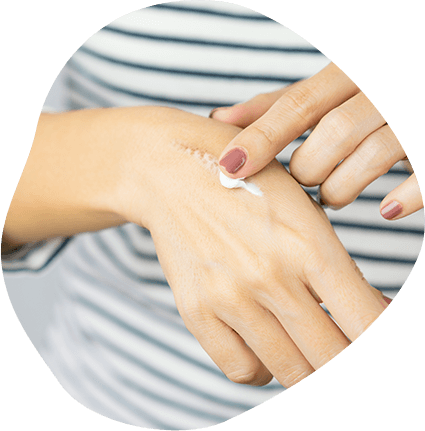 Minimizing the Appearance of Scars