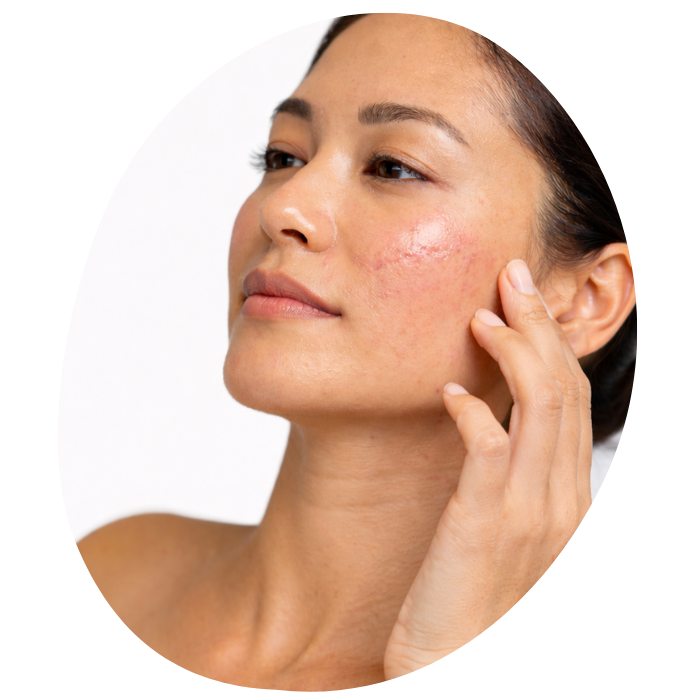 Minimizing the Appearance of Scars