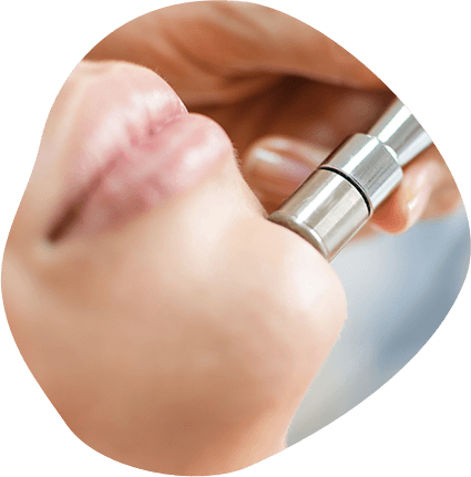 Microdermabrasion