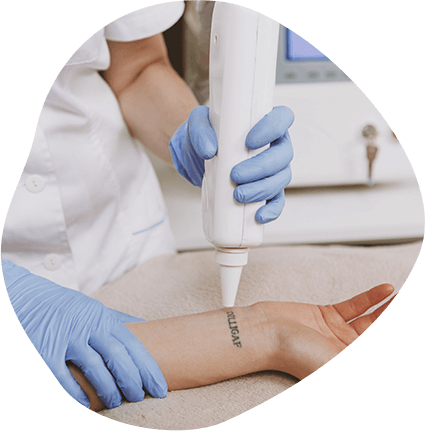 Removal Without Scarring