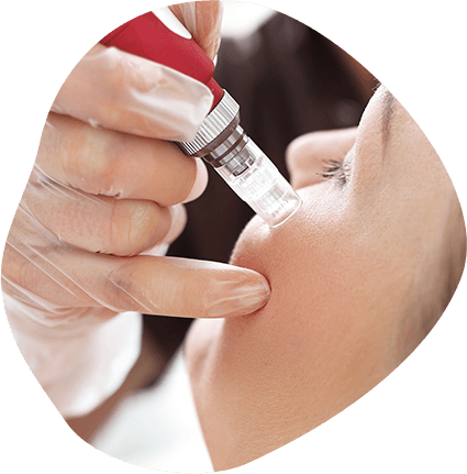 Give Your Skin a Natural Jumpstart