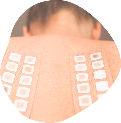 Get to the Source of Your Allergies