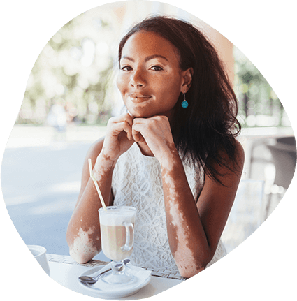 Vitiligo: What is it?