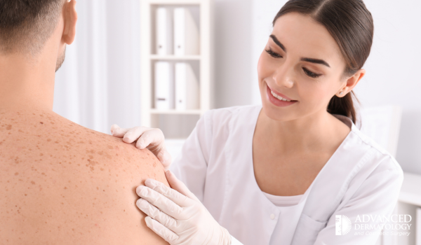 Denver Dermatology Consultants Wheat Ridge Co Wheatridge Dermatologist | Denver Dermatology Consultants