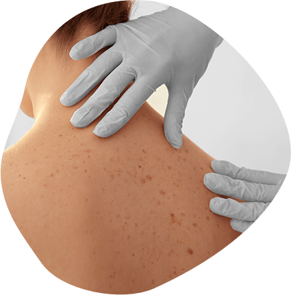 Early Detection and Treatment