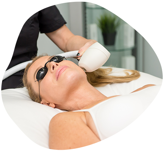 Venus Versa™ Intense Pulsed Light (IPL)/Photofacial